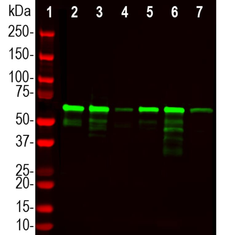 Western Blot - Anti-PLS1 Antibody (A333287) - Antibodies.com