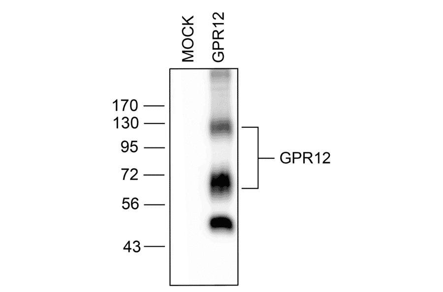 Western blot - Anti-GPCR GPR12 Antibody (A334456) - Antibodies.com