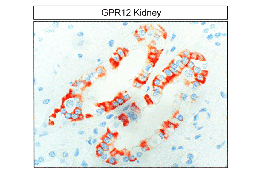 Immunohistochemistry - Anti-GPCR GPR12 Antibody (A334456) - Antibodies.com