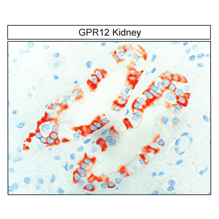 Immunohistochemistry - Anti-GPCR GPR12 Antibody (A334456) - Antibodies.com