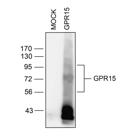 Western blot - Anti-GPCR GPR15 Antibody (A334458) - Antibodies.com