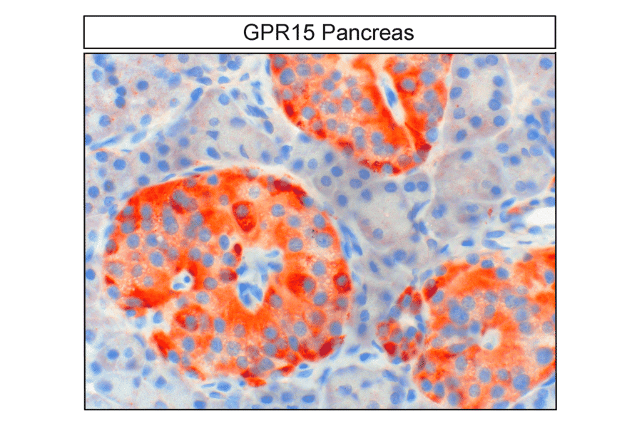 Immunohistochemistry - Anti-GPCR GPR15 Antibody (A334458) - Antibodies.com