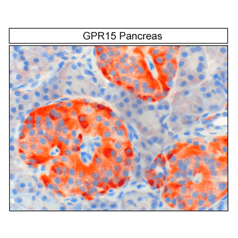 Immunohistochemistry - Anti-GPCR GPR15 Antibody (A334458) - Antibodies.com