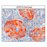 Immunohistochemistry - Anti-GPCR GPR15 Antibody (A334458) - Antibodies.com