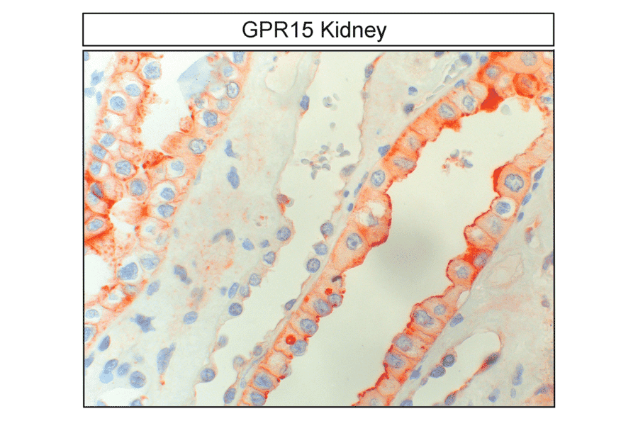 Immunohistochemistry - Anti-GPCR GPR15 Antibody (A334458) - Antibodies.com