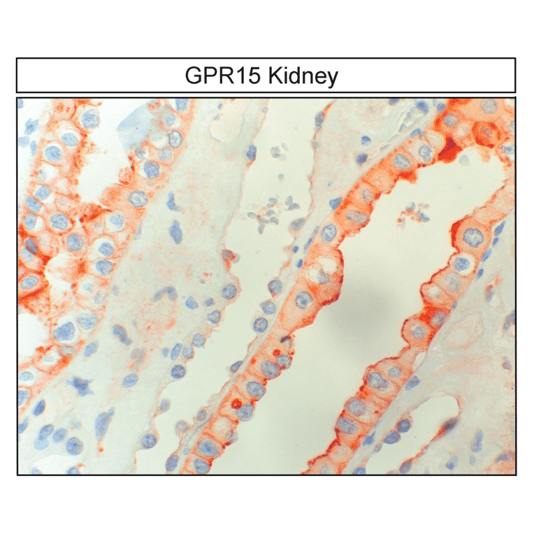 Immunohistochemistry - Anti-GPCR GPR15 Antibody (A334458) - Antibodies.com