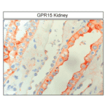 Immunohistochemistry - Anti-GPCR GPR15 Antibody (A334458) - Antibodies.com