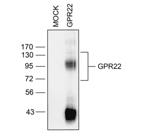 Western blot - Anti-GPR22 Antibody (A334460) - Antibodies.com