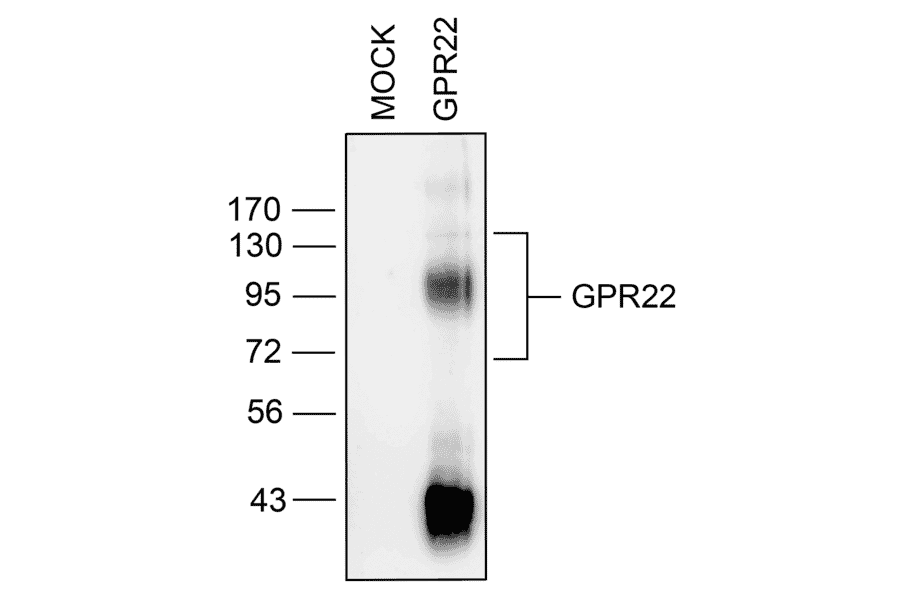 Western blot - Anti-GPR22 Antibody (A334460) - Antibodies.com