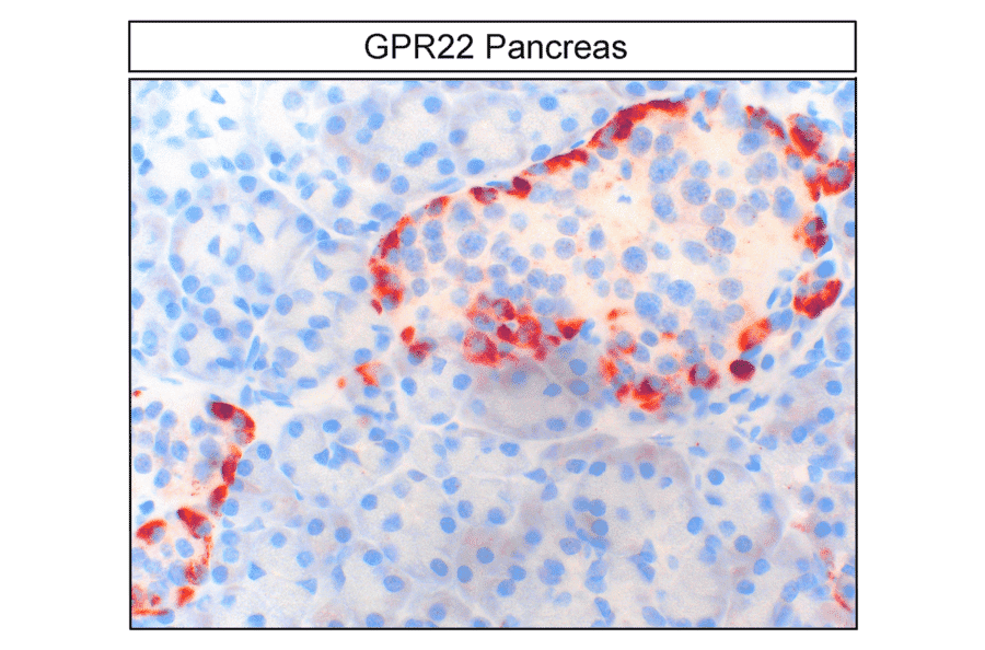 Immunohistochemistry - Anti-GPR22 Antibody (A334460) - Antibodies.com
