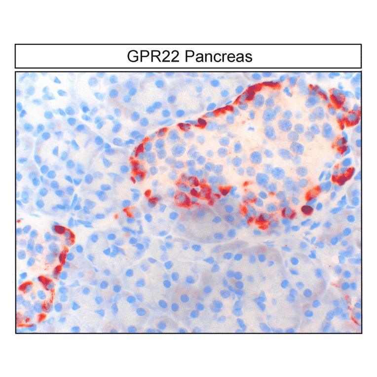 Immunohistochemistry - Anti-GPR22 Antibody (A334460) - Antibodies.com