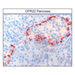 Immunohistochemistry - Anti-GPR22 Antibody (A334460) - Antibodies.com
