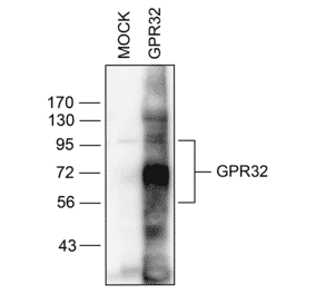 Western blot - Anti-GPCR GPR32 Antibody (A334463) - Antibodies.com
