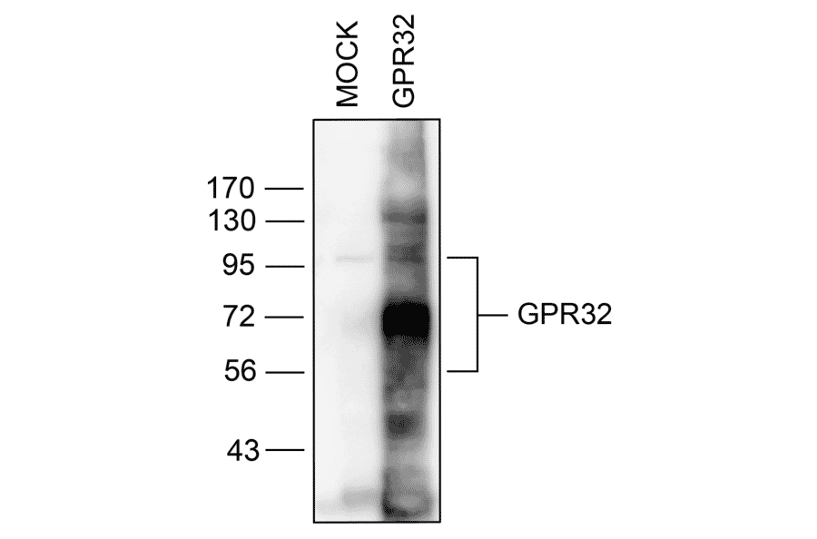 Western blot - Anti-GPCR GPR32 Antibody (A334463) - Antibodies.com