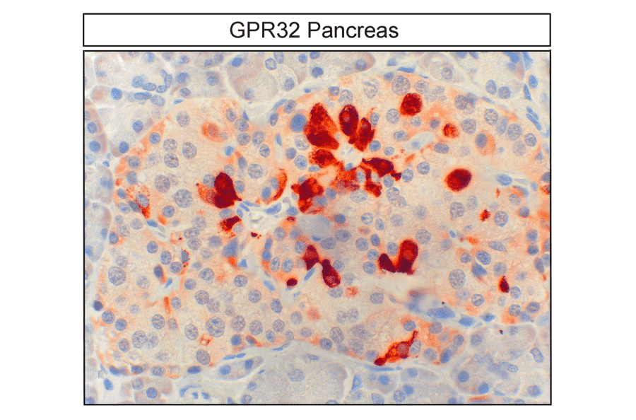 Immunohistochemistry - Anti-GPCR GPR32 Antibody (A334463) - Antibodies.com