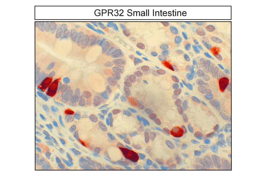 Immunohistochemistry - Anti-GPCR GPR32 Antibody (A334463) - Antibodies.com