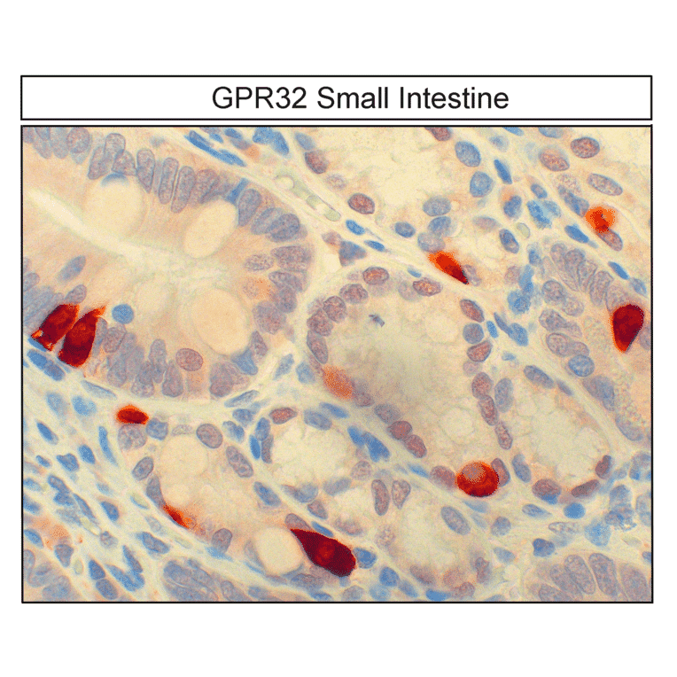 Immunohistochemistry - Anti-GPCR GPR32 Antibody (A334463) - Antibodies.com