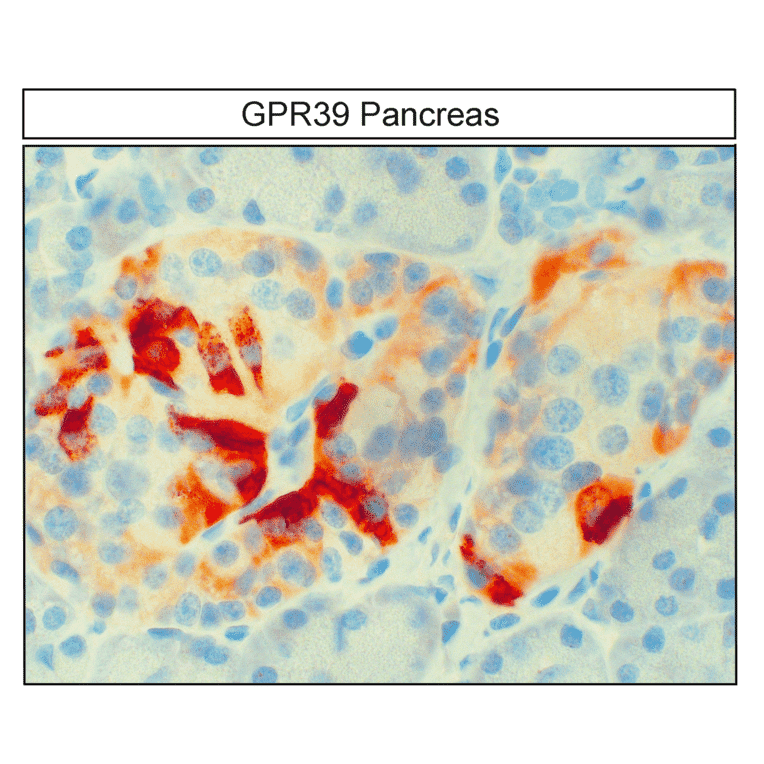 Immunohistochemistry - Anti-GPR39 Antibody (A334465) - Antibodies.com