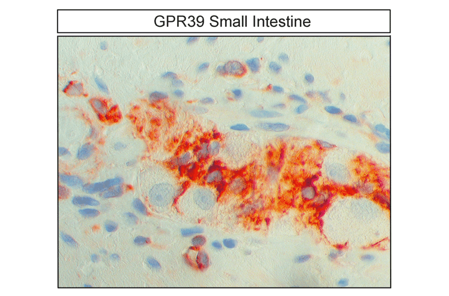 Immunohistochemistry - Anti-GPR39 Antibody (A334465) - Antibodies.com