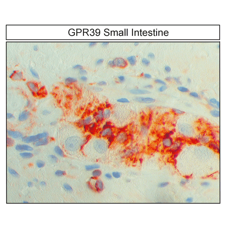 Immunohistochemistry - Anti-GPR39 Antibody (A334465) - Antibodies.com