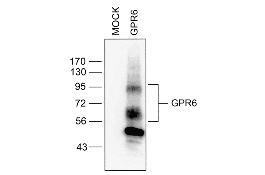 Western blot - Anti-GPCR GPR6 Antibody (A334468) - Antibodies.com
