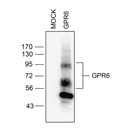 Western blot - Anti-GPCR GPR6 Antibody (A334468) - Antibodies.com