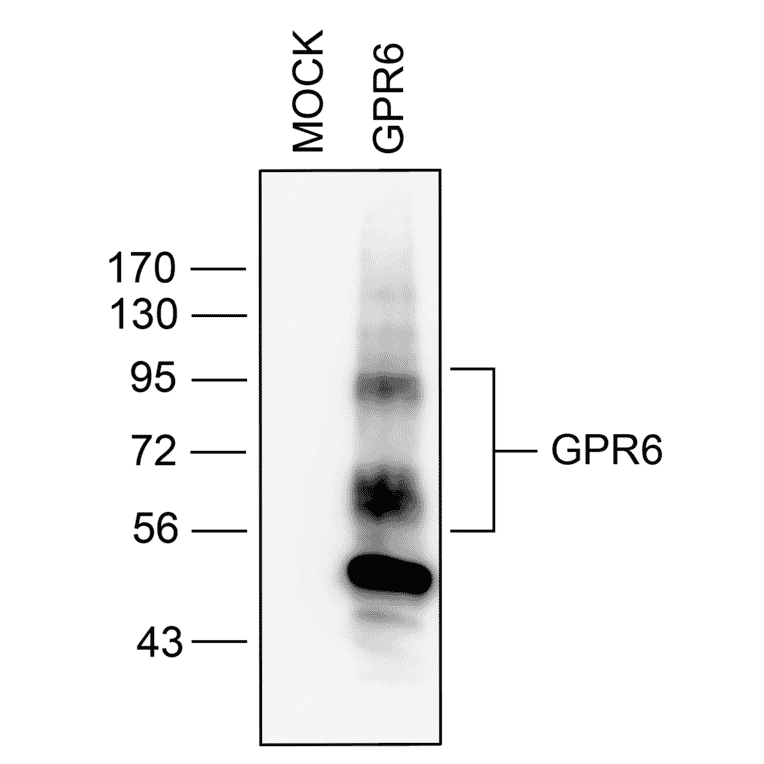 Western blot - Anti-GPCR GPR6 Antibody (A334468) - Antibodies.com
