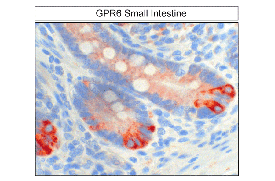 Immunohistochemistry - Anti-GPCR GPR6 Antibody (A334468) - Antibodies.com