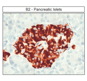 Immunohistochemistry - Anti-BDKRB2 Antibody (A334472) - Antibodies.com