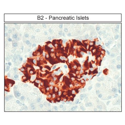 Immunohistochemistry - Anti-BDKRB2 Antibody (A334472) - Antibodies.com