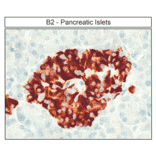 Immunohistochemistry - Anti-BDKRB2 Antibody (A334472) - Antibodies.com
