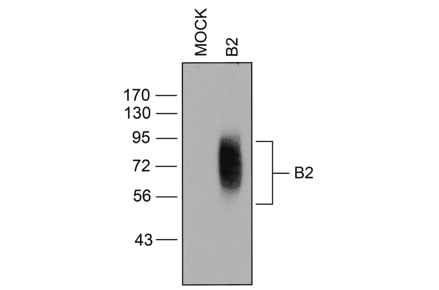 Western blot - Anti-BDKRB2 Antibody (A334472) - Antibodies.com