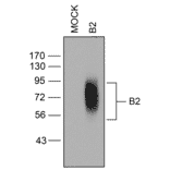 Western blot - Anti-BDKRB2 Antibody (A334472) - Antibodies.com