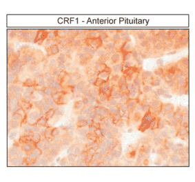 Immunohistochemistry - Anti-CRF1 Antibody (A334474) - Antibodies.com
