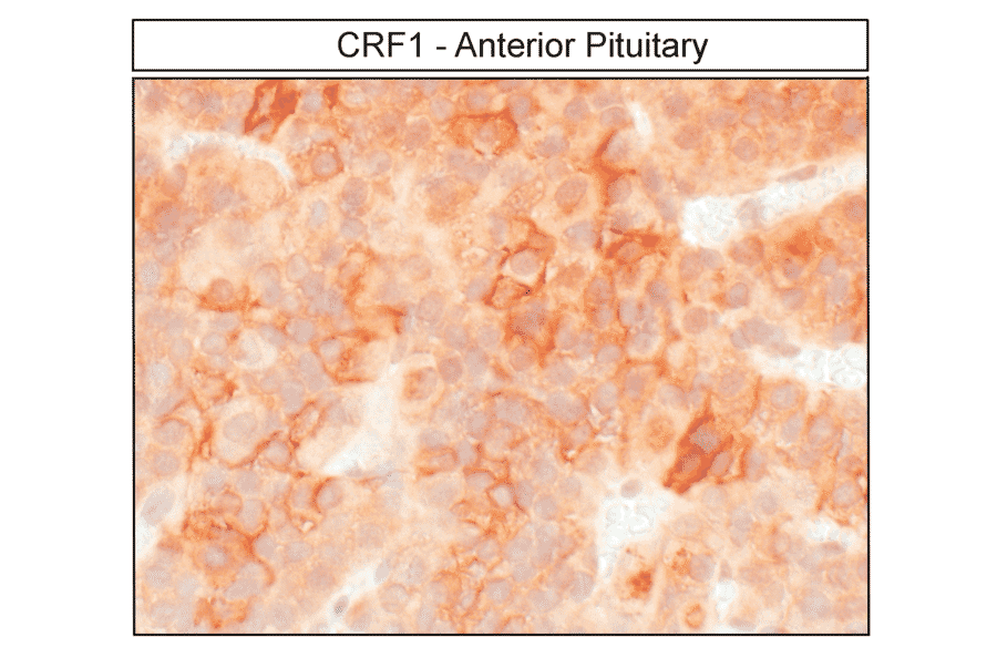 Immunohistochemistry - Anti-CRF1 Antibody (A334474) - Antibodies.com