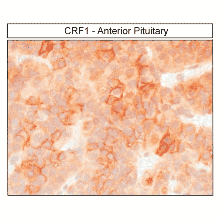 Immunohistochemistry - Anti-CRF1 Antibody (A334474) - Antibodies.com