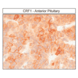 Immunohistochemistry - Anti-CRF1 Antibody (A334474) - Antibodies.com