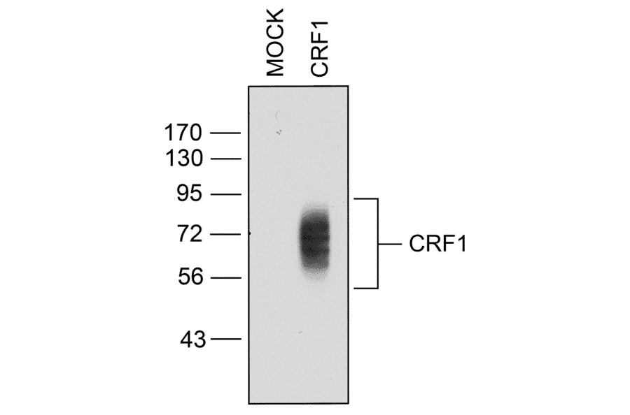 Western blot - Anti-CRF1 Antibody (A334474) - Antibodies.com