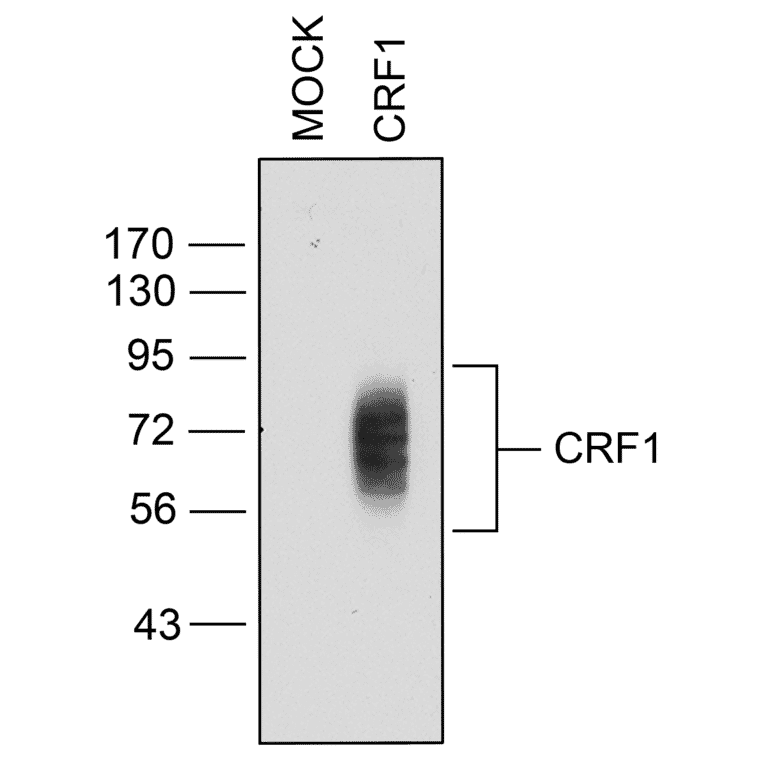 Western blot - Anti-CRF1 Antibody (A334474) - Antibodies.com