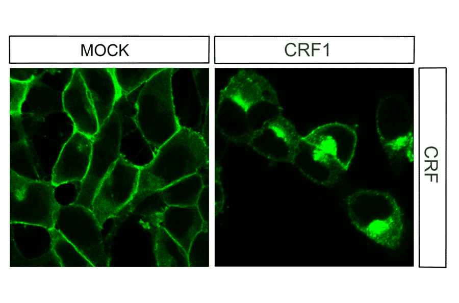 Immunohistochemistry - Anti-CRF1 Antibody (A334474) - Antibodies.com