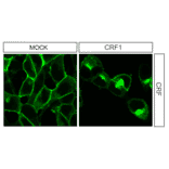 Immunohistochemistry - Anti-CRF1 Antibody (A334474) - Antibodies.com