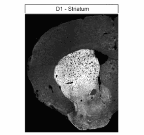 Immunohistochemistry - Anti-DRD1 Antibody (A334475) - Antibodies.com