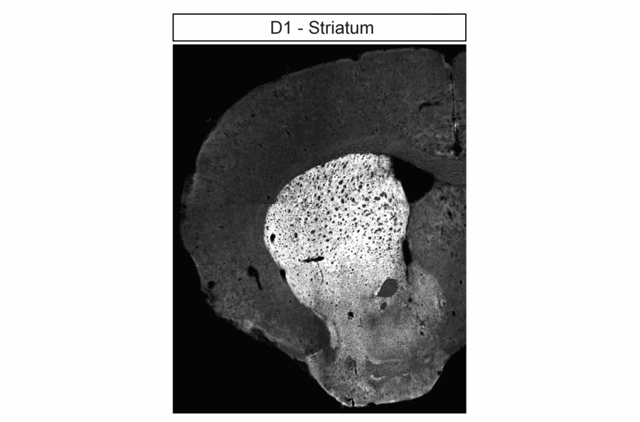 Immunohistochemistry - Anti-DRD1 Antibody (A334475) - Antibodies.com