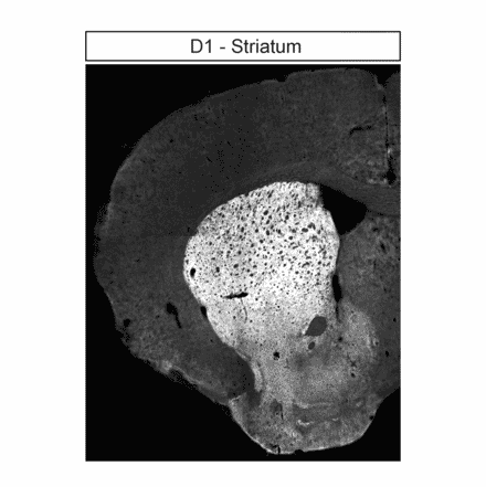 Immunohistochemistry - Anti-DRD1 Antibody (A334475) - Antibodies.com
