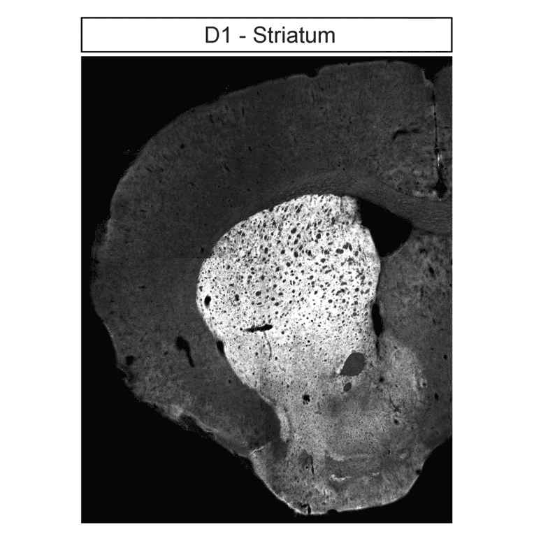Immunohistochemistry - Anti-DRD1 Antibody (A334475) - Antibodies.com