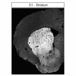 Immunohistochemistry - Anti-DRD1 Antibody (A334475) - Antibodies.com