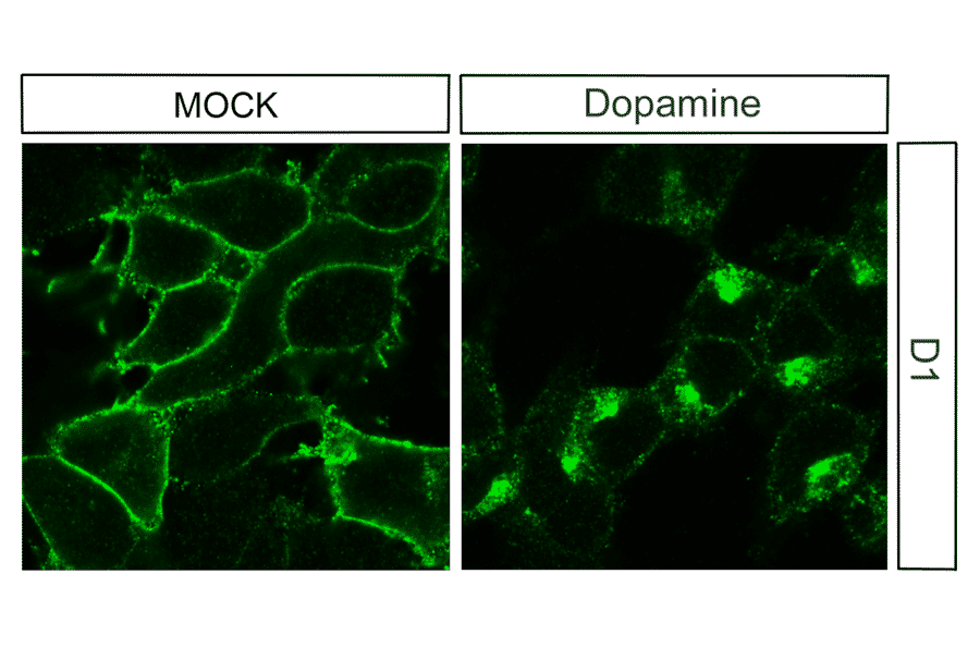 Immunohistochemistry - Anti-DRD1 Antibody (A334475) - Antibodies.com