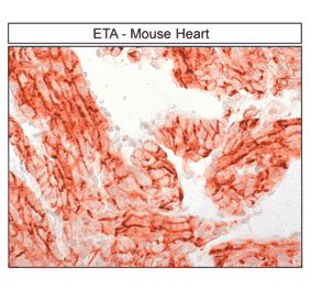 Immunohistochemistry - Anti-Endothelin A Receptor Antibody (A334476) - Antibodies.com
