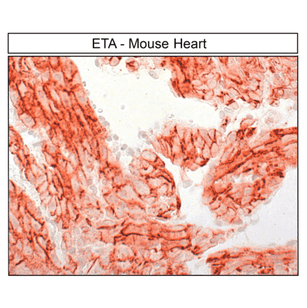 Immunohistochemistry - Anti-Endothelin A Receptor Antibody (A334476) - Antibodies.com