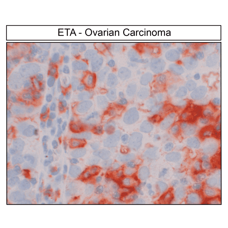 Immunohistochemistry - Anti-Endothelin A Receptor Antibody (A334476) - Antibodies.com